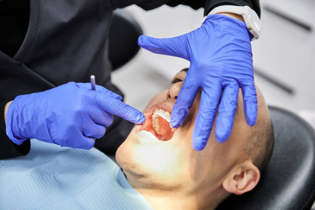Best Emergency Root Canal Treatment in Louisvle, IL