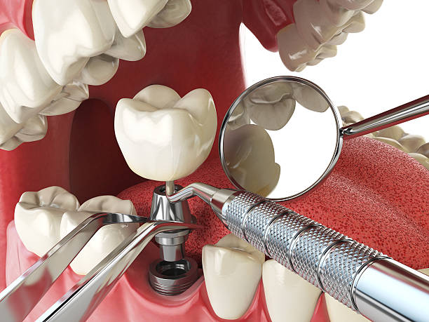 Best Urgent Dental Care for Toothache in Louisvle, IL